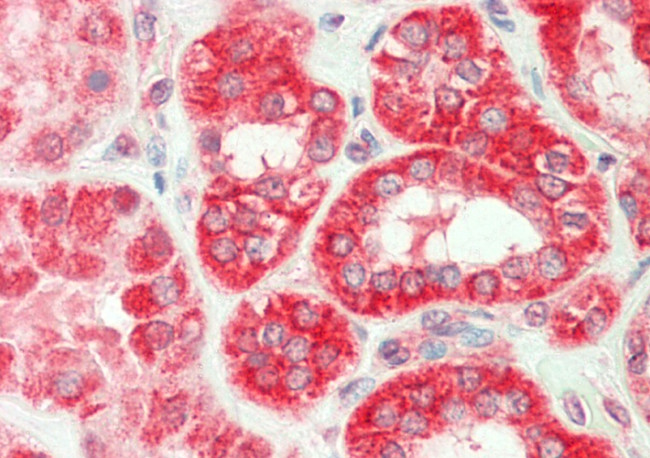 TNF beta Antibody in Immunohistochemistry (Paraffin) (IHC (P))