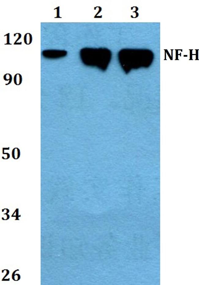NF-H Antibody in Western Blot (WB)