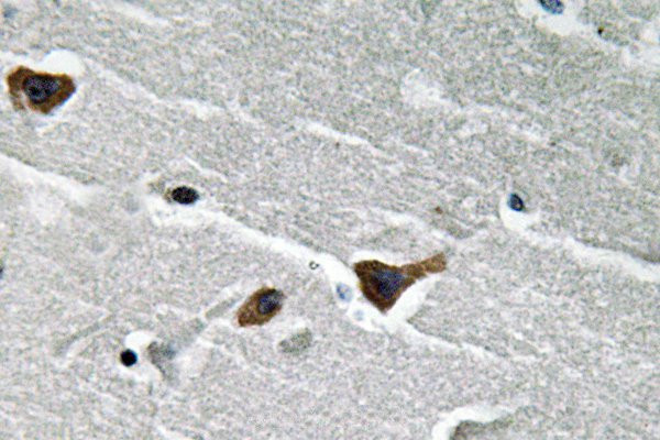 PAI1 Antibody in Immunohistochemistry (Paraffin) (IHC (P))