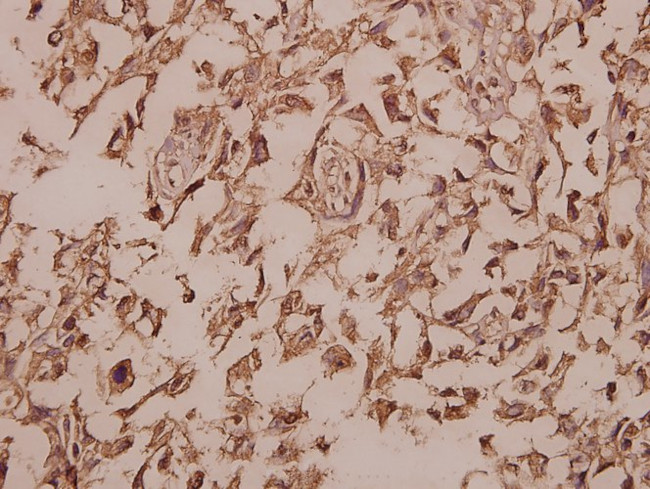 Cytokeratin 13 Antibody in Immunohistochemistry (Paraffin) (IHC (P))