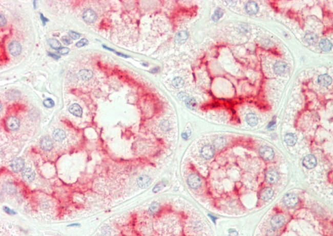 CD13 Antibody in Immunohistochemistry (Paraffin) (IHC (P))