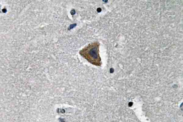 ROCK1 Antibody in Immunohistochemistry (Paraffin) (IHC (P))