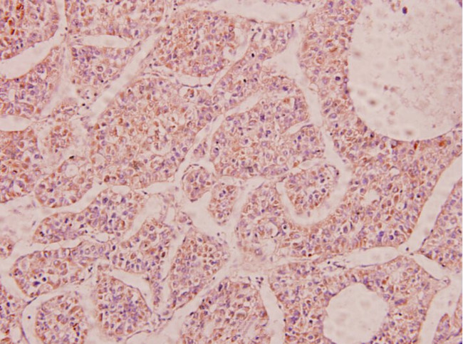 NPY Antibody in Immunohistochemistry (Paraffin) (IHC (P))