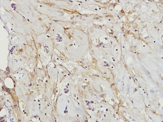 Paxillin Antibody in Immunohistochemistry (Paraffin) (IHC (P))