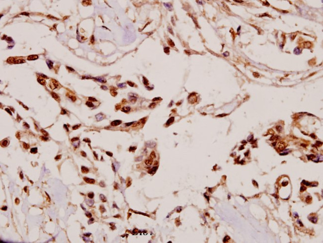 VASP Antibody in Immunohistochemistry (Paraffin) (IHC (P))