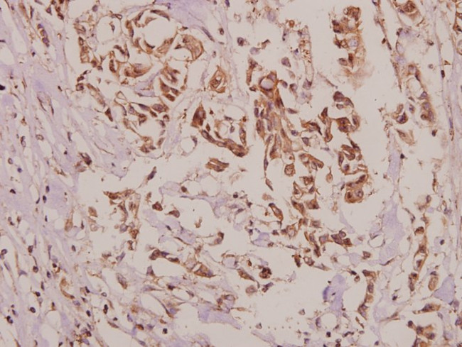 VASP Antibody in Immunohistochemistry (Paraffin) (IHC (P))