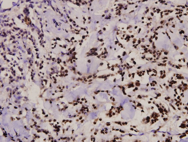 Zap-70 Antibody in Immunohistochemistry (Paraffin) (IHC (P))