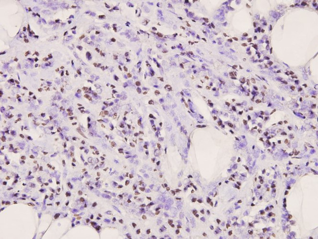 IkB alpha Antibody in Immunohistochemistry (Paraffin) (IHC (P))