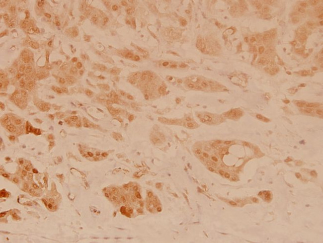 Stathmin 1 Antibody in Immunohistochemistry (Paraffin) (IHC (P))