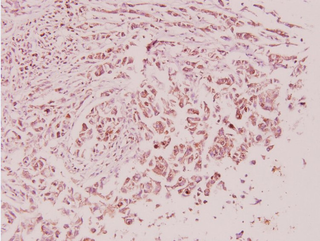 SP1 Antibody in Immunohistochemistry (Paraffin) (IHC (P))