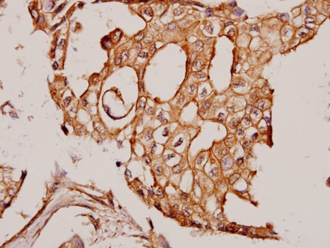 Cortactin Antibody in Immunohistochemistry (Paraffin) (IHC (P))
