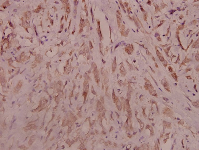 TrkB Antibody in Immunohistochemistry (Paraffin) (IHC (P))
