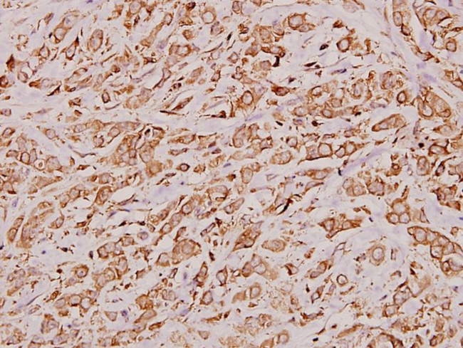 Cathepsin D Antibody in Immunohistochemistry (Paraffin) (IHC (P))