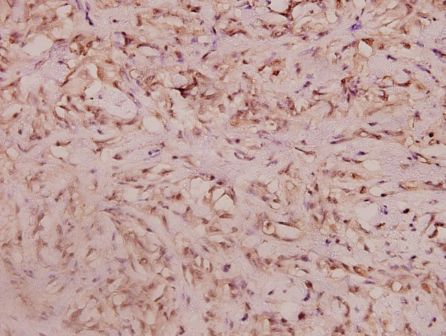 Haptoglobin Antibody in Immunohistochemistry (Paraffin) (IHC (P))