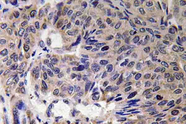 MFN2 Antibody in Immunohistochemistry (Paraffin) (IHC (P))