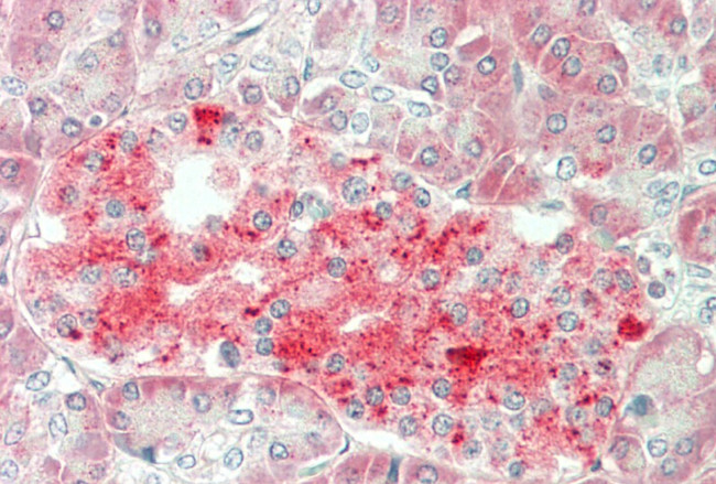 SERPINB2 Antibody in Immunohistochemistry (Paraffin) (IHC (P))