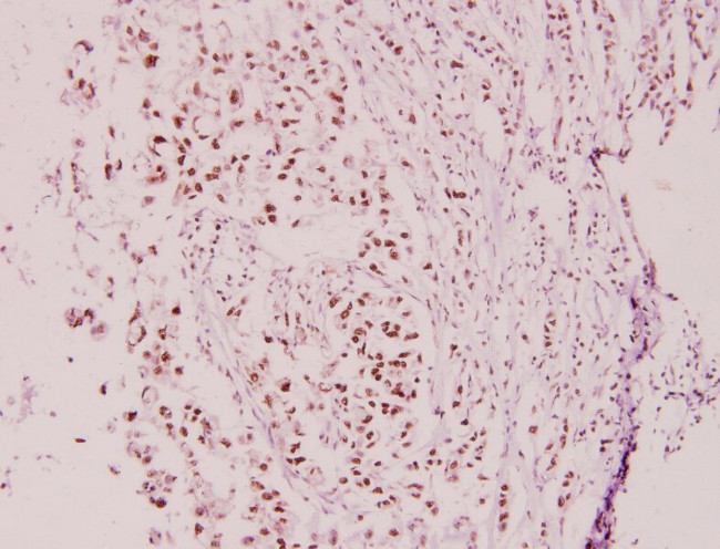 Cyclin E2 Antibody in Immunohistochemistry (Paraffin) (IHC (P))