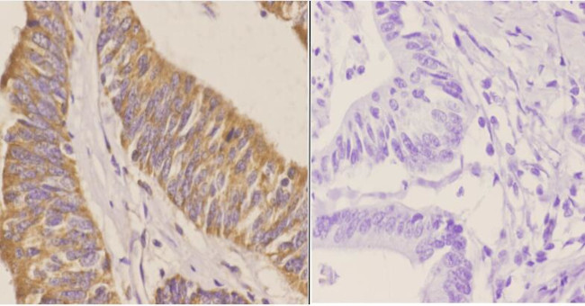 CD171 Antibody in Immunohistochemistry (Paraffin) (IHC (P))