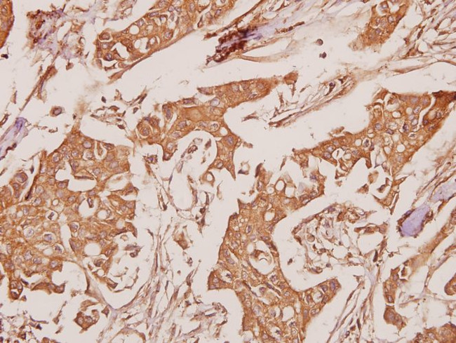 ATP5A1 Antibody in Immunohistochemistry (Paraffin) (IHC (P))