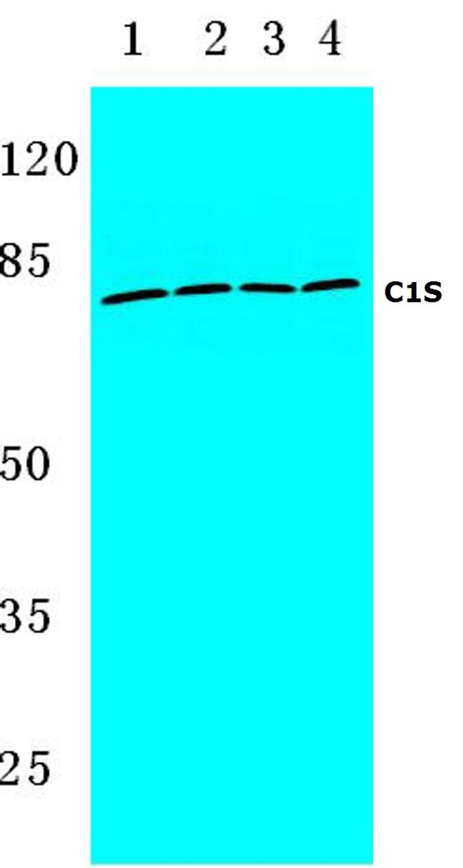 C1S Antibody in Western Blot (WB)