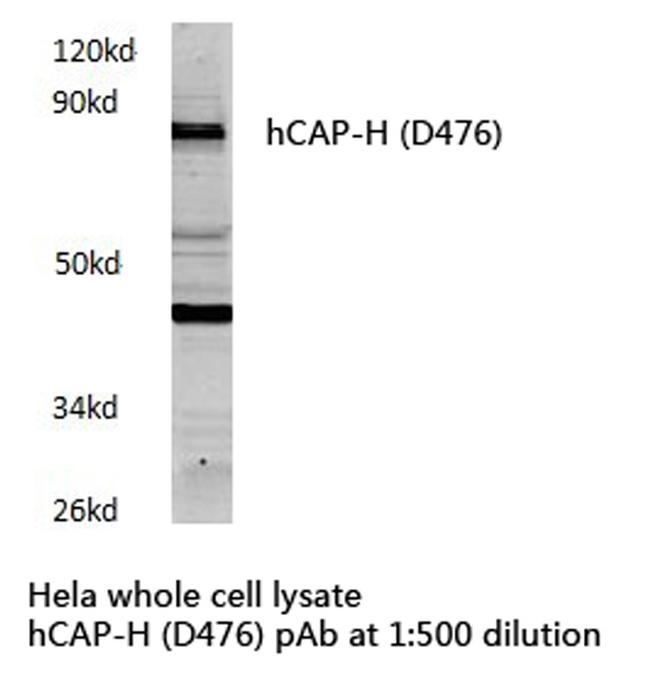 NCAPH Antibody in Western Blot (WB)