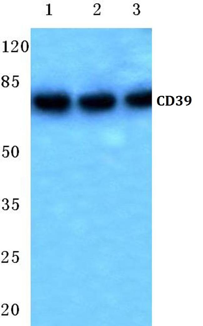 CD39 Antibody in Western Blot (WB)