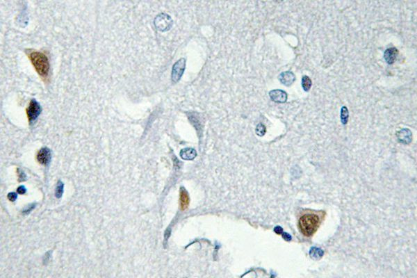 Phospho-Histone H2A.X (Ser139) Antibody in Immunohistochemistry (Paraffin) (IHC (P))