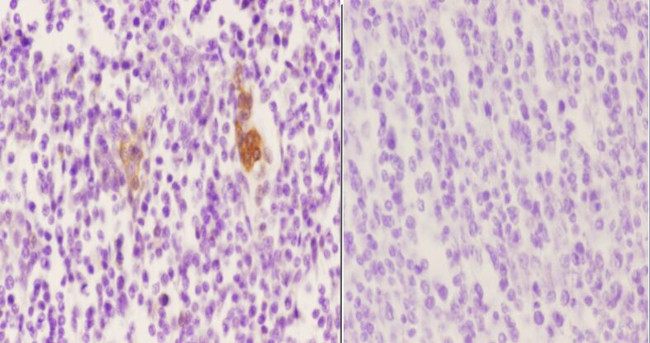 Phospho-Vimentin (Ser56) Antibody in Immunohistochemistry (Paraffin) (IHC (P))