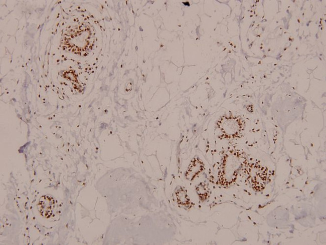 Phospho-ATM (Ser1981) Antibody in Immunohistochemistry (Paraffin) (IHC (P))