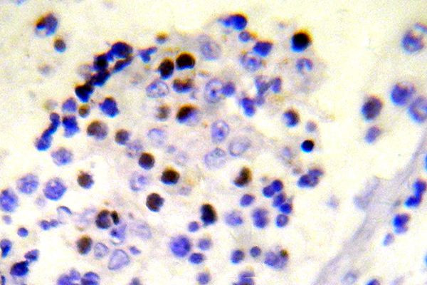 Phospho-Histone H2A.X (Ser139) Antibody in Immunohistochemistry (Paraffin) (IHC (P))