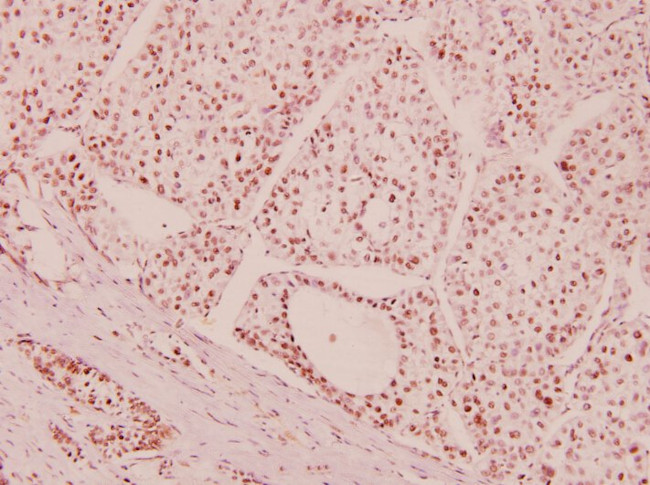 ATM Antibody in Immunohistochemistry (Paraffin) (IHC (P))