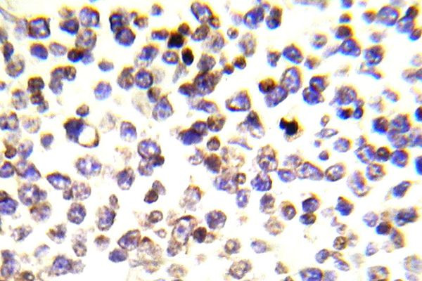 Histone H2A.X Antibody in Immunohistochemistry (Paraffin) (IHC (P))