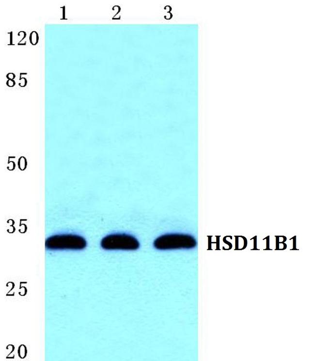 HSD11B1 Antibody in Western Blot (WB)