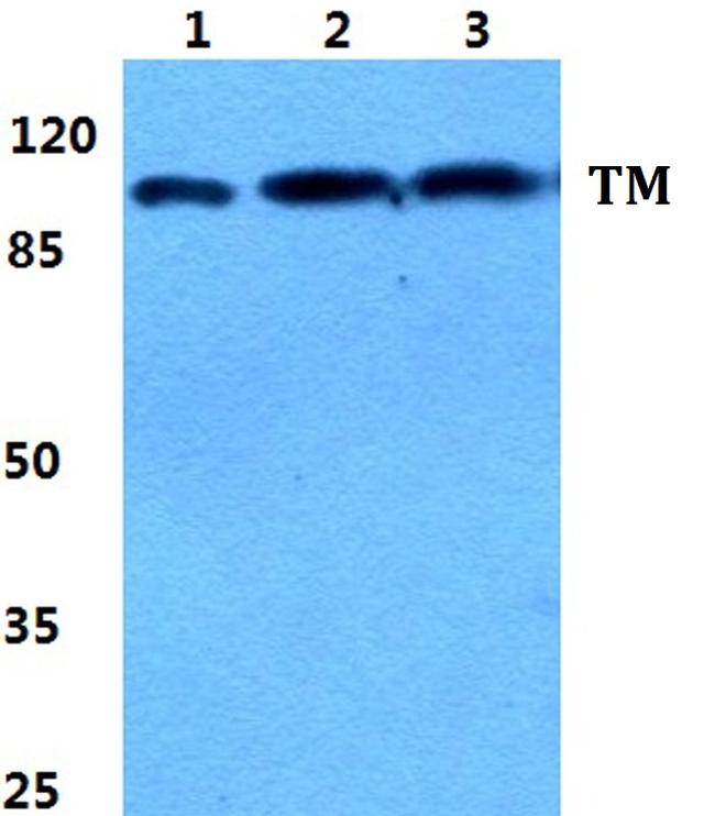 Thrombomodulin Antibody in Western Blot (WB)