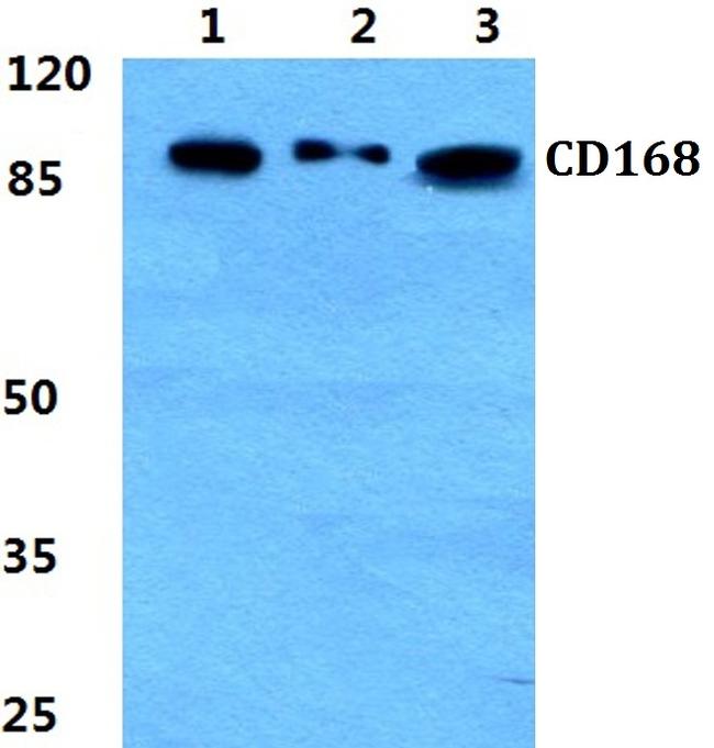 RHAMM Antibody in Western Blot (WB)