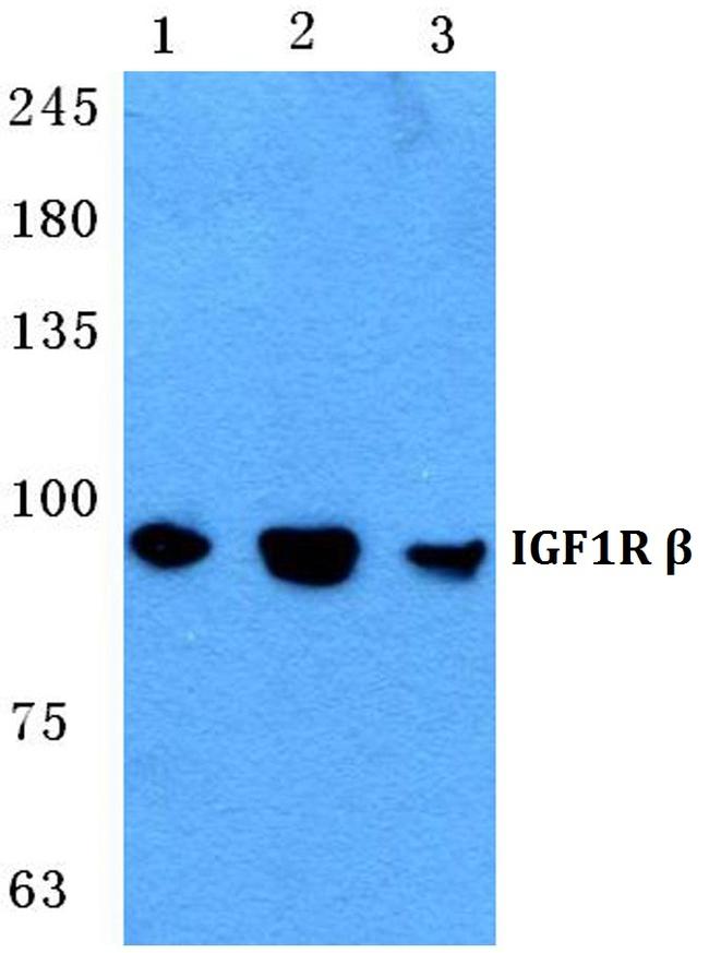 IGF1R (CD221) Antibody in Western Blot (WB)