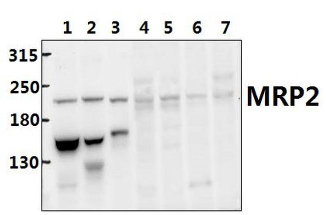 MRP2 Antibody in Western Blot (WB)