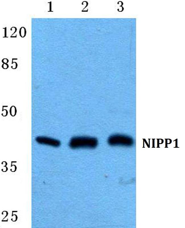 PPP1R8 Antibody in Western Blot (WB)
