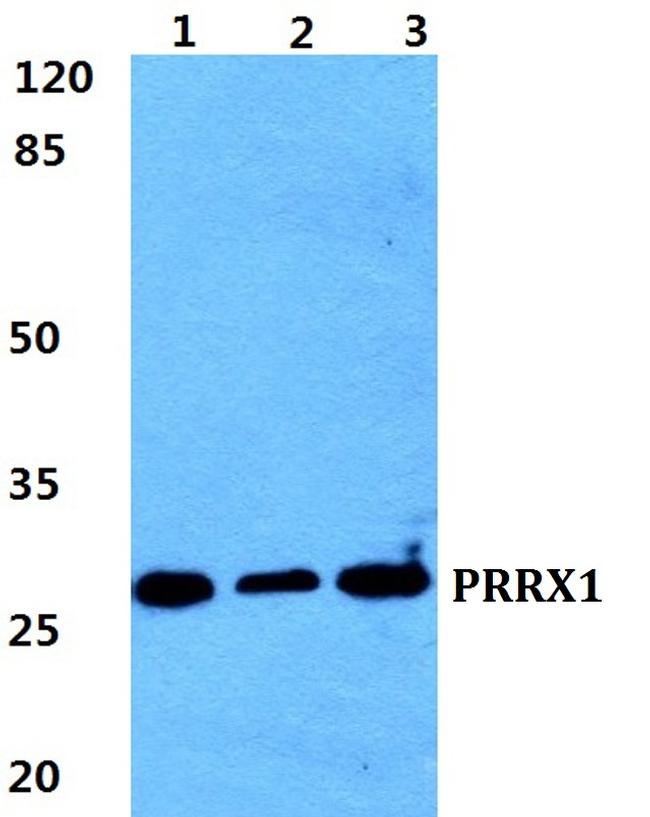 PRRX1 Antibody in Western Blot (WB)