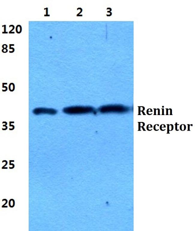 ATP6IP2 Antibody in Western Blot (WB)
