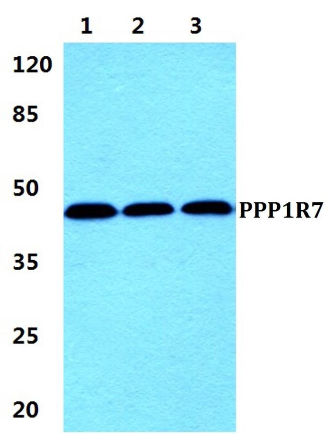 PPP1R7 Antibody in Western Blot (WB)