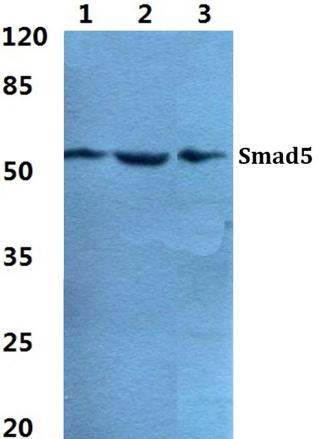 SMAD5 Antibody in Western Blot (WB)