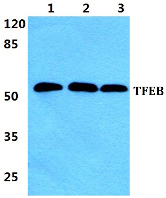TFEB Antibody in Western Blot (WB)
