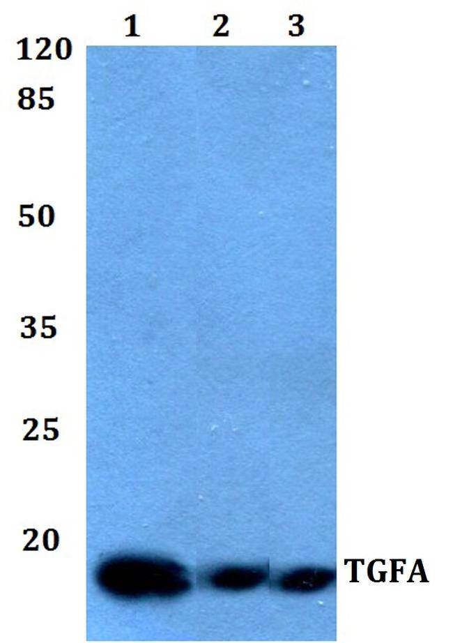 TGF alpha Antibody in Western Blot (WB)