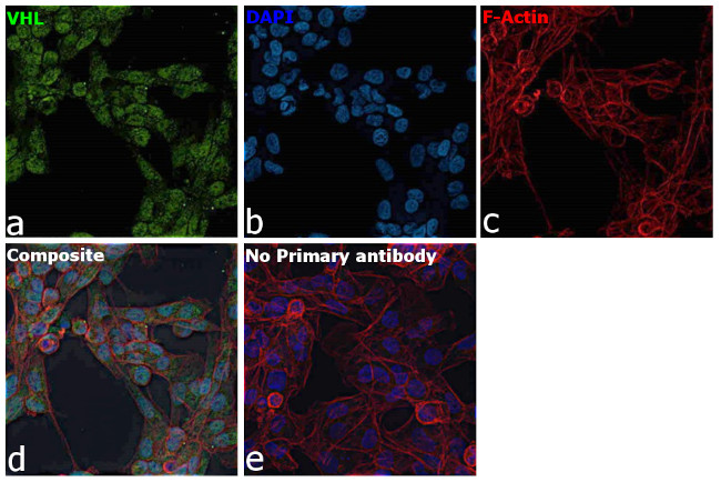 VHL Antibody in Immunocytochemistry (ICC/IF)