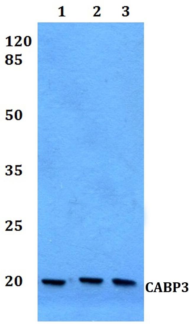 CABP5 Antibody in Western Blot (WB)