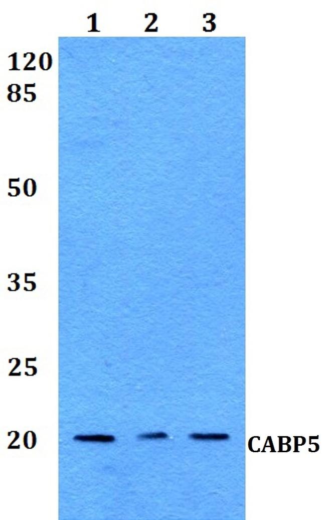 CABP5 Antibody in Western Blot (WB)