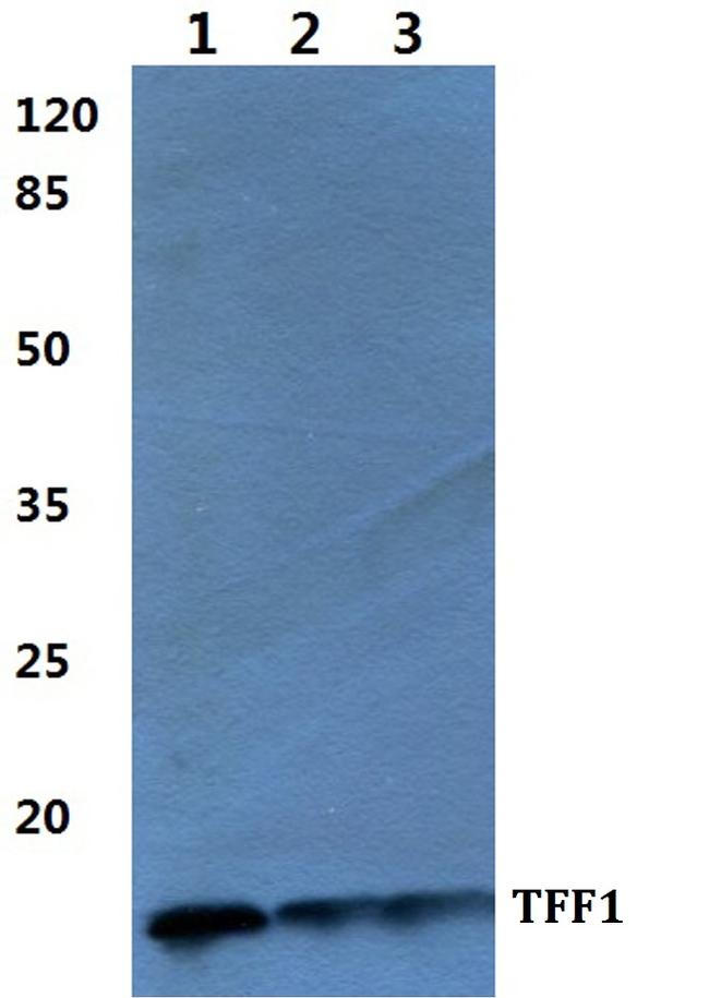 TFF1 Antibody in Western Blot (WB)