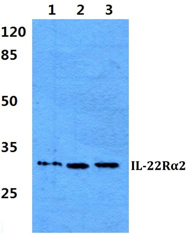 IL22RA2 Antibody in Western Blot (WB)