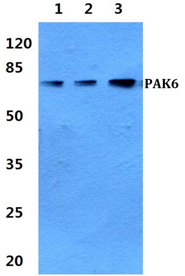 PAK6 Antibody in Western Blot (WB)